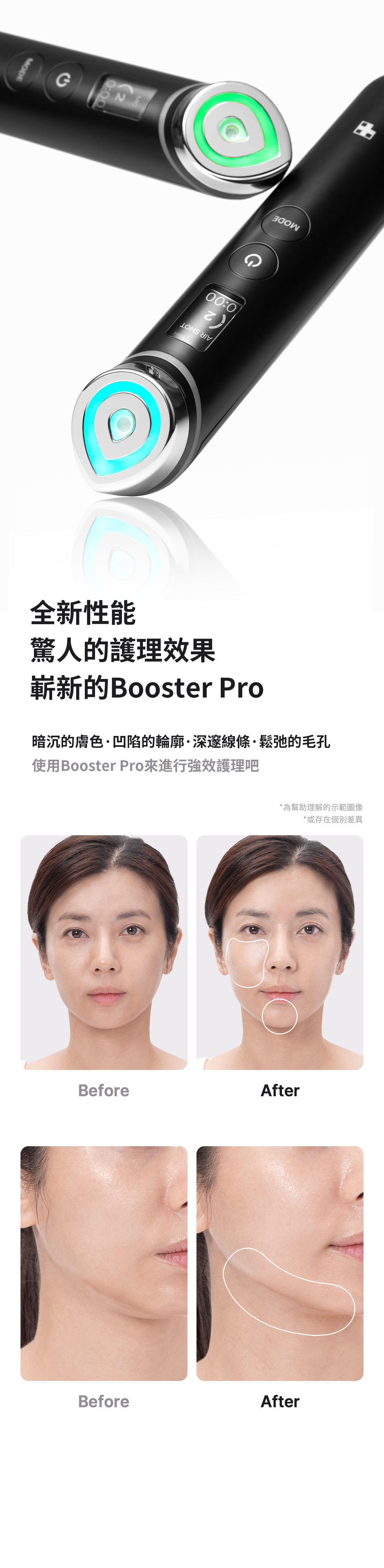 六種技術於一身的終極美容儀器 ⭐️Medicube 6合1 Booster Pro逆齡提升水光針導入美容儀🧏🏻♀️