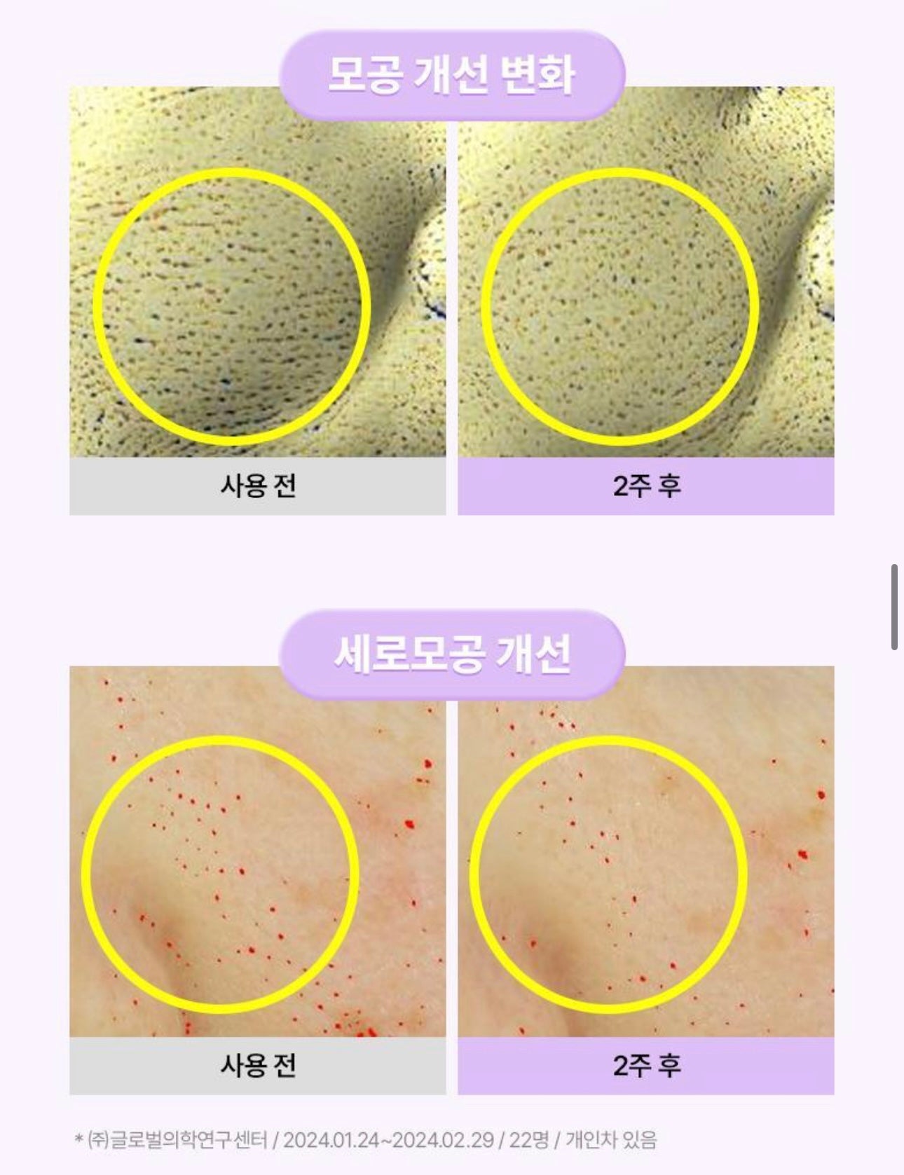 BIOHEAL BOH 益生菌膠原蛋白重塑紋理精華| PROBIODERM™ COLLAGEN REMODELING SERUM GEOBIODER