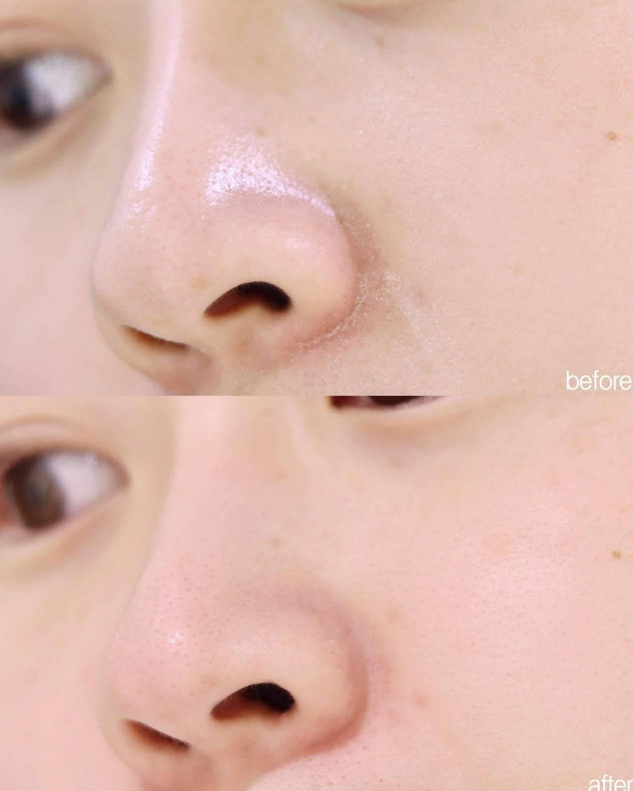 蒸氣疏通毛孔🫧| Torhop 桑拿海鹽去痘收毛孔溫熱面膜🧖🏻♀️🩶| Torhop Saunan Heating Salt Mask