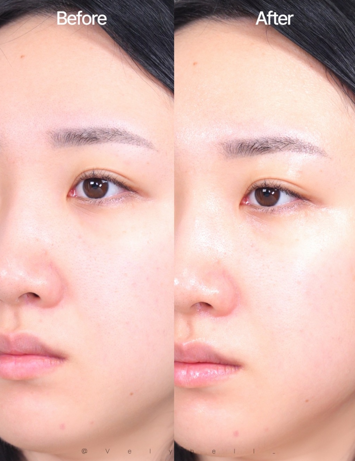 針對瑕疵和痘印 ✨| Mediheal 活性積雪草鎮靜去印保濕面膜| Mediheal Madecassoide Essential Mask🌿