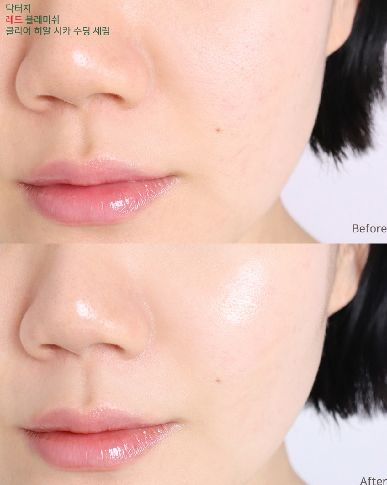 專為敏感肌膚而設💚| Dr.G 舒緩降紅去痘保濕修復精華 Red Blemish Clear Hyal Cica Soothing Serum