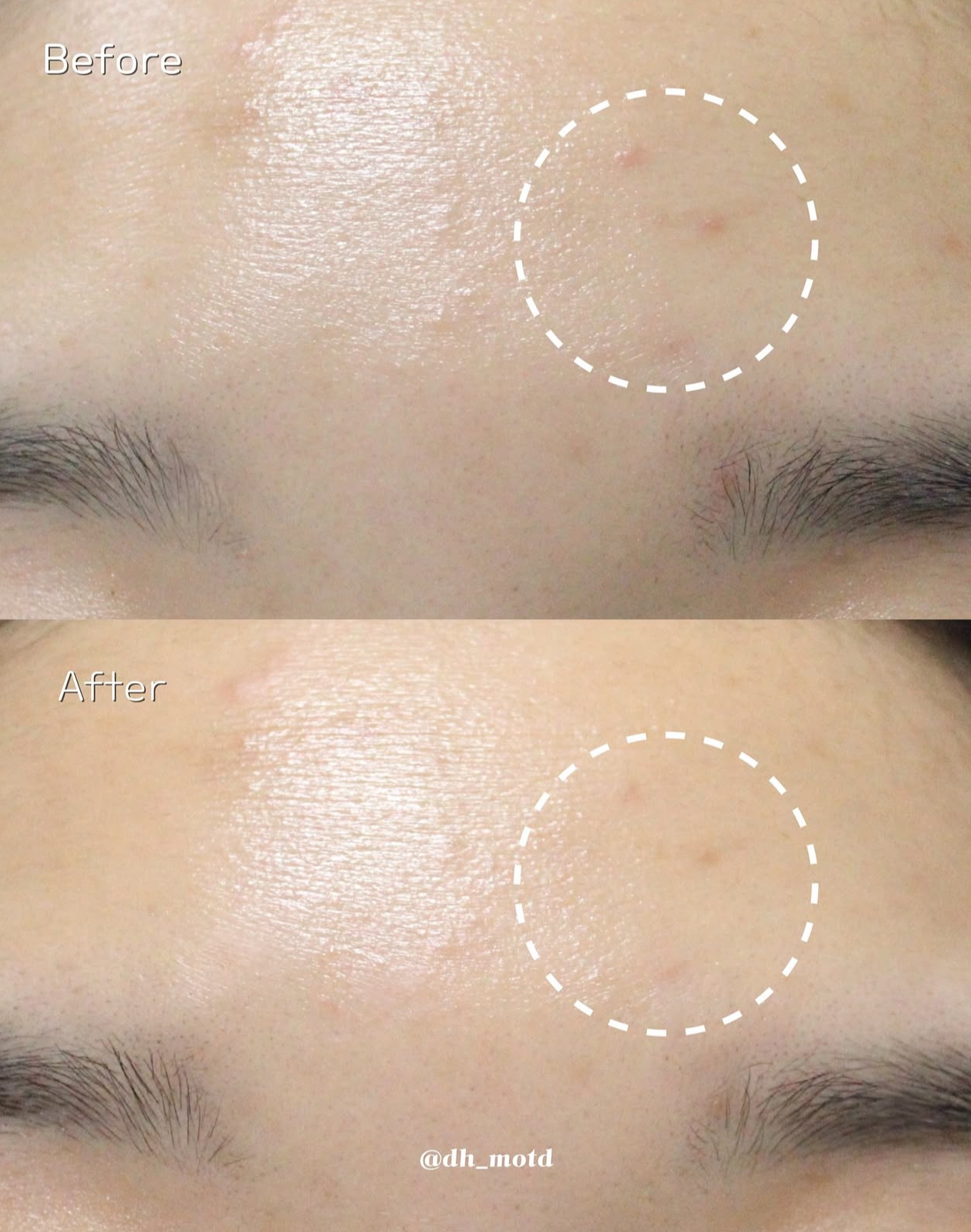 即時舒緩肌膚🌿 Make prem 專利積雪草抗痘強效舒緩保濕面霜💚| Make prem Inteca Soothing Cream