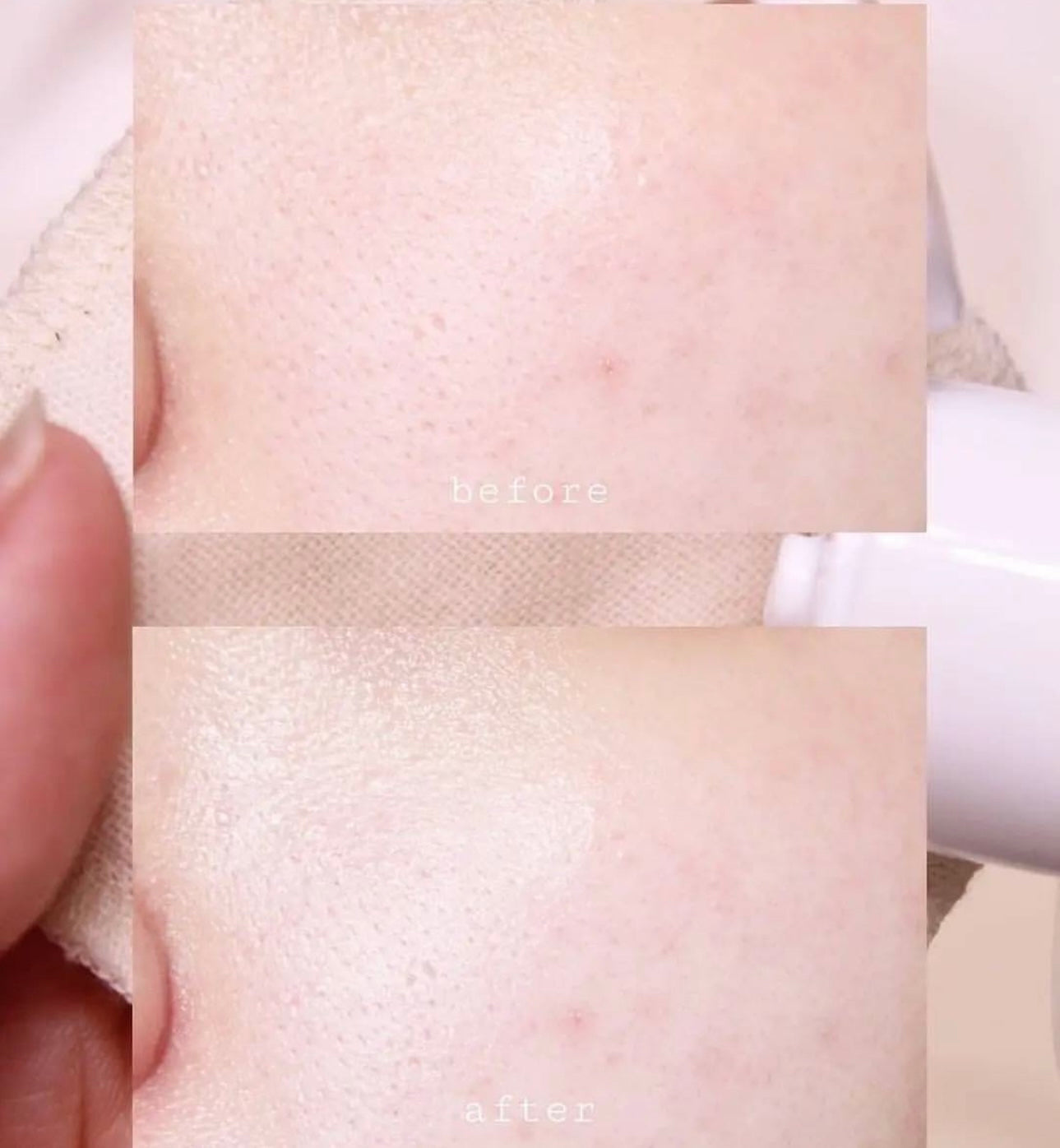 Beplain Greenful Balancing Toner綠豆調節爽膚水200ml💦| 韓國Olive Young人氣排行榜人氣超高💫