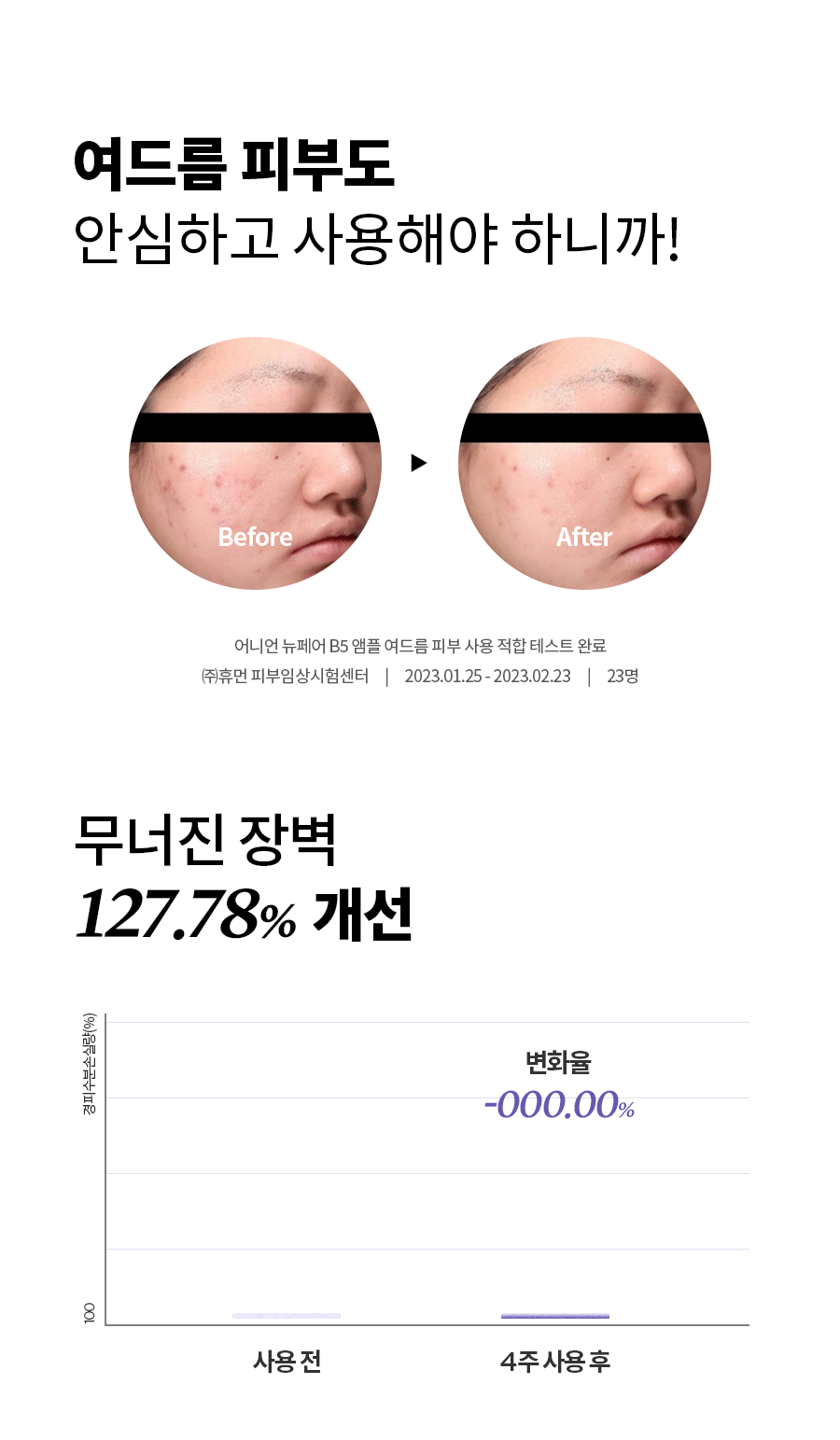 去印修復🧅 Isntree 紫洋蔥去印修復B5精華| ISNTREE ONION NEWPAIR B5 AMPOULE💫