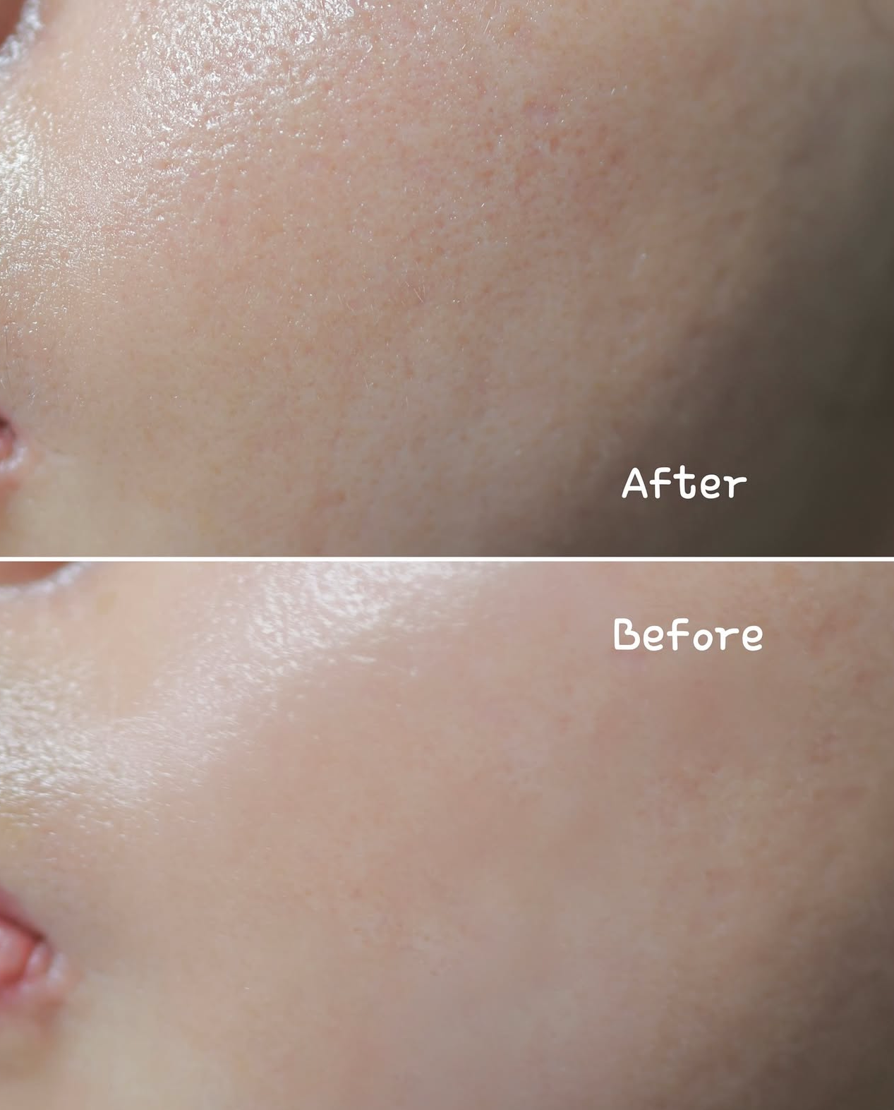 一抹彈滑 細緻毛孔✨ BOH 膠原蛋白毛孔急緊膚急救棉片|PROBIODERM™ Collagen Remodeling Serum Pads💜