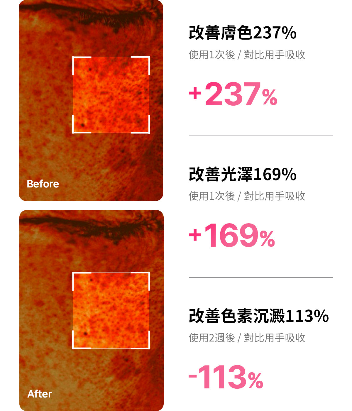 Medicube亮白煥膚美容儀AGE-R Booster Pro Mini✨