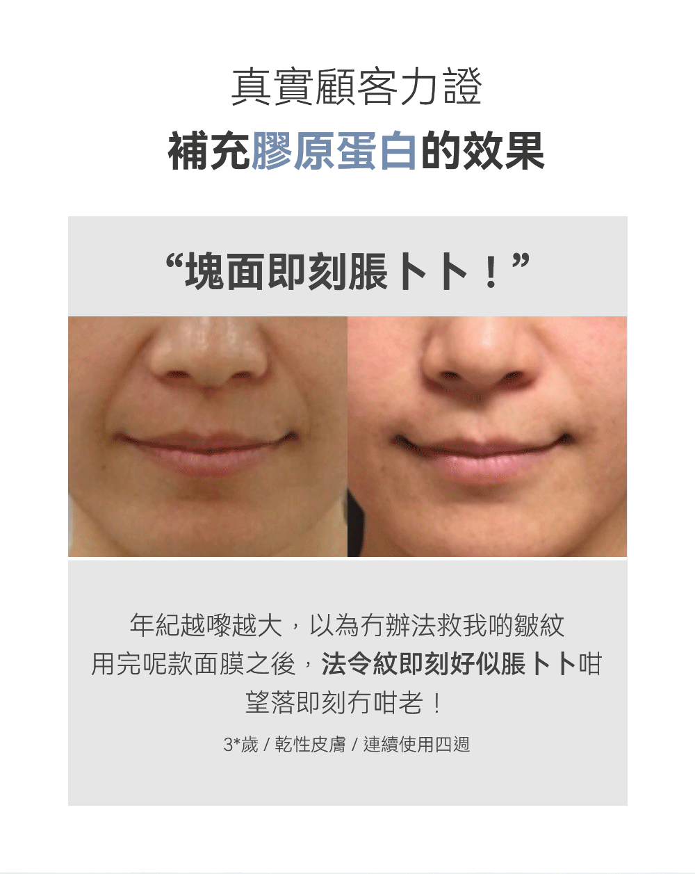 敷上面的水光針效果💉| SUNGBOON EDITOR 重塑膠原蛋白🥚深層膠原蛋白抗皺提拉過夜面膜Olive Young 面膜1位🥇