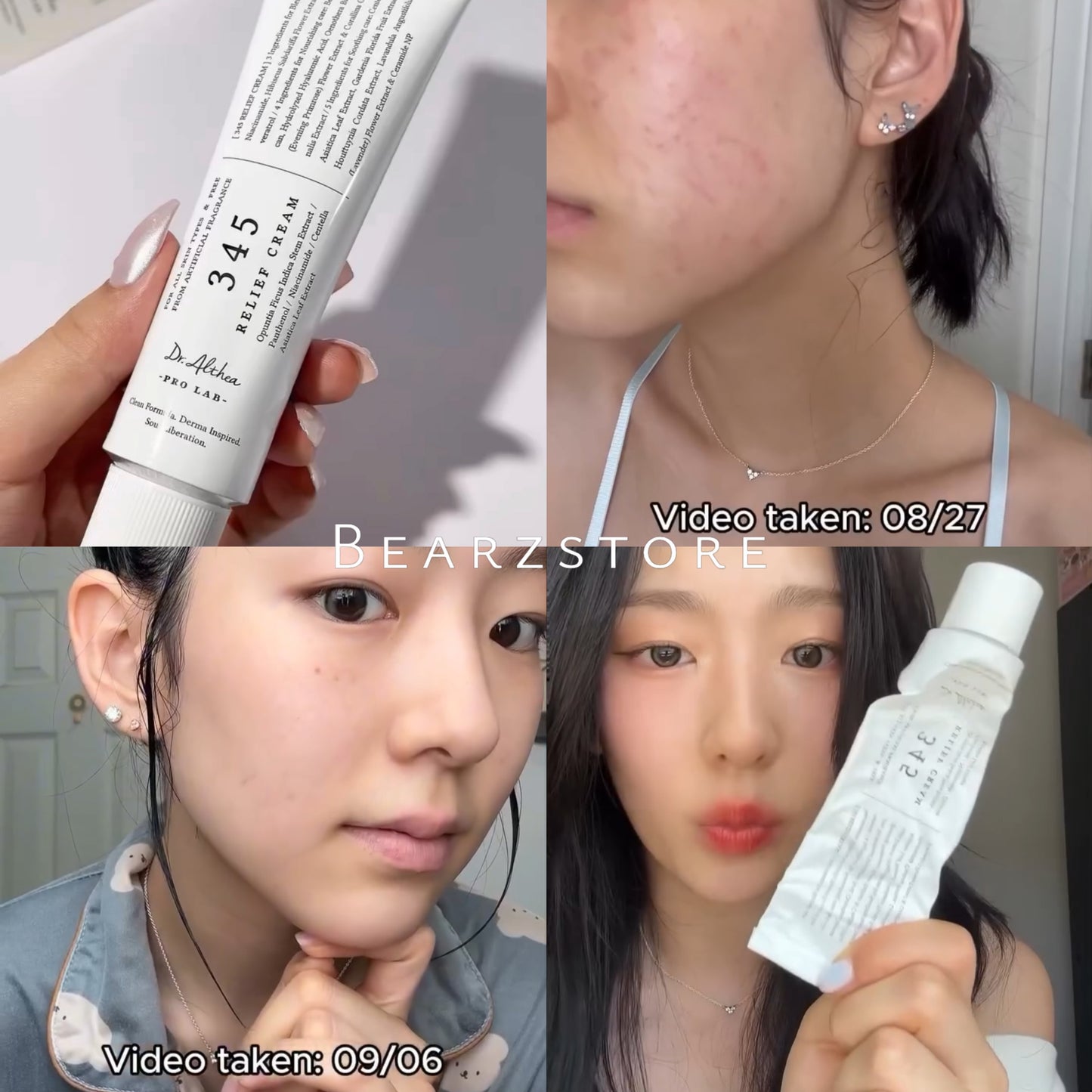 專爲解決痘痘爆發後遺症✨|Dr.Althea 345 白藜盧醇抗糖抗衰老去印修復霜🔥| Dr.Althea 345 Relief Cream