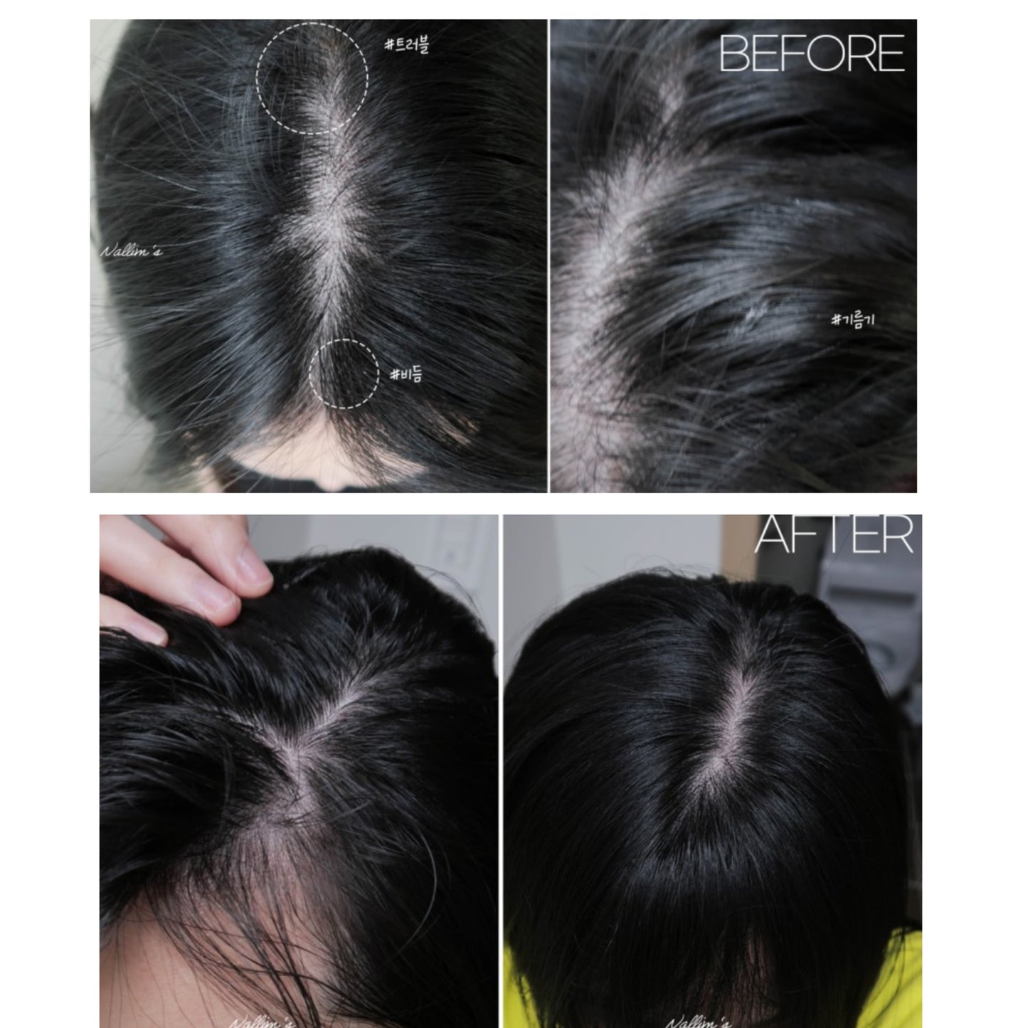 海水浴療法💆🏼♀️| GROWUS Sea Salt Therapy Scalp Scaler 海鹽去角質磨砂膏💫 韓國銷量冠軍產品 No.1🥂