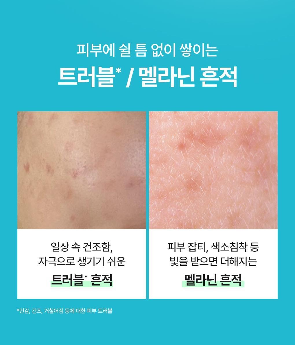 共5款!MEDIHEAL 包裹式精華面膜系列✨