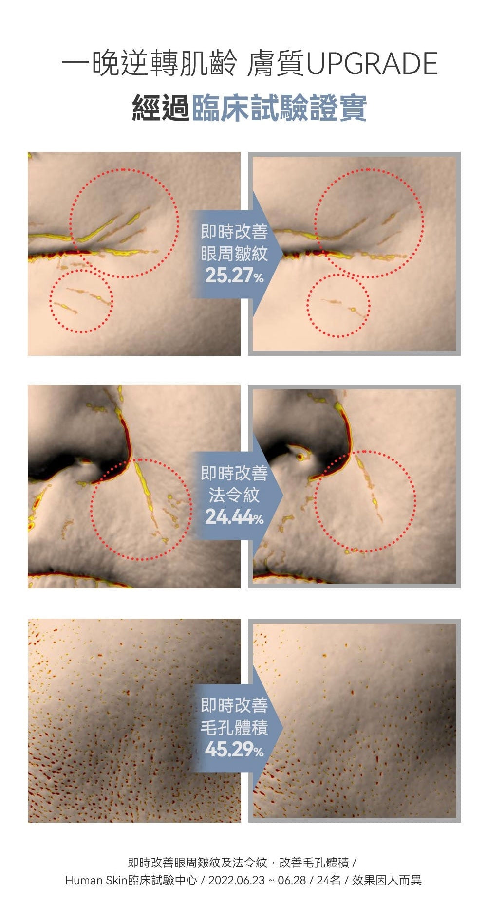 敷上面的水光針效果💉| SUNGBOON EDITOR 重塑膠原蛋白🥚深層膠原蛋白抗皺提拉過夜面膜Olive Young 面膜1位🥇
