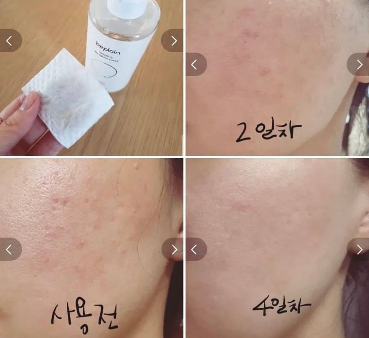 Beplain Greenful Balancing Toner綠豆調節爽膚水200ml💦| 韓國Olive Young人氣排行榜人氣超高💫