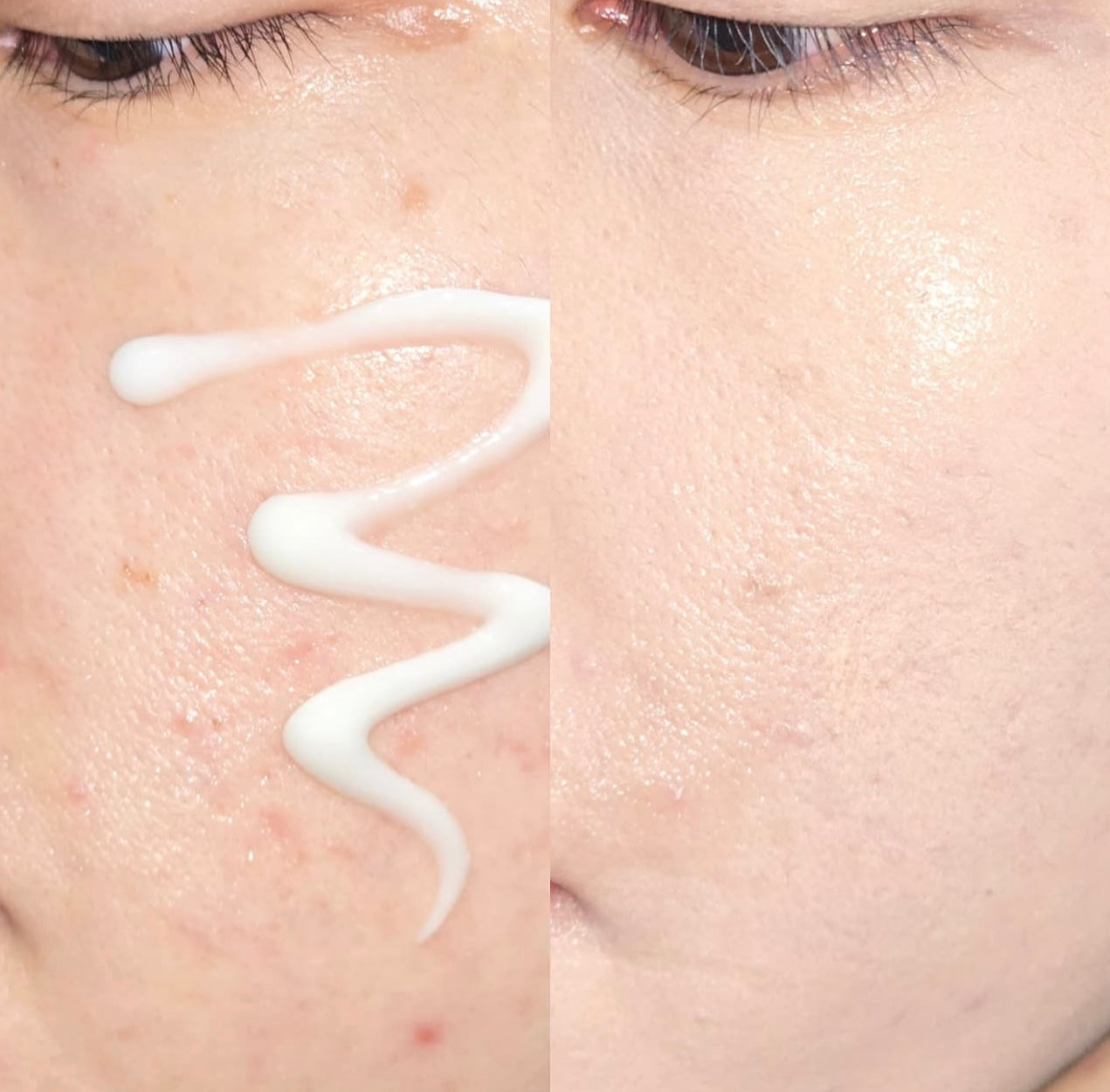 韓國專業醫美級護膚品牌👩🏼⚕️|DERMAFIRM 谷胱甘肽去瑕疵光感面霜💜✨| 雙重美白成分⭐️| DERMAFIRM SOOTHING REPAIR TONING CREAM