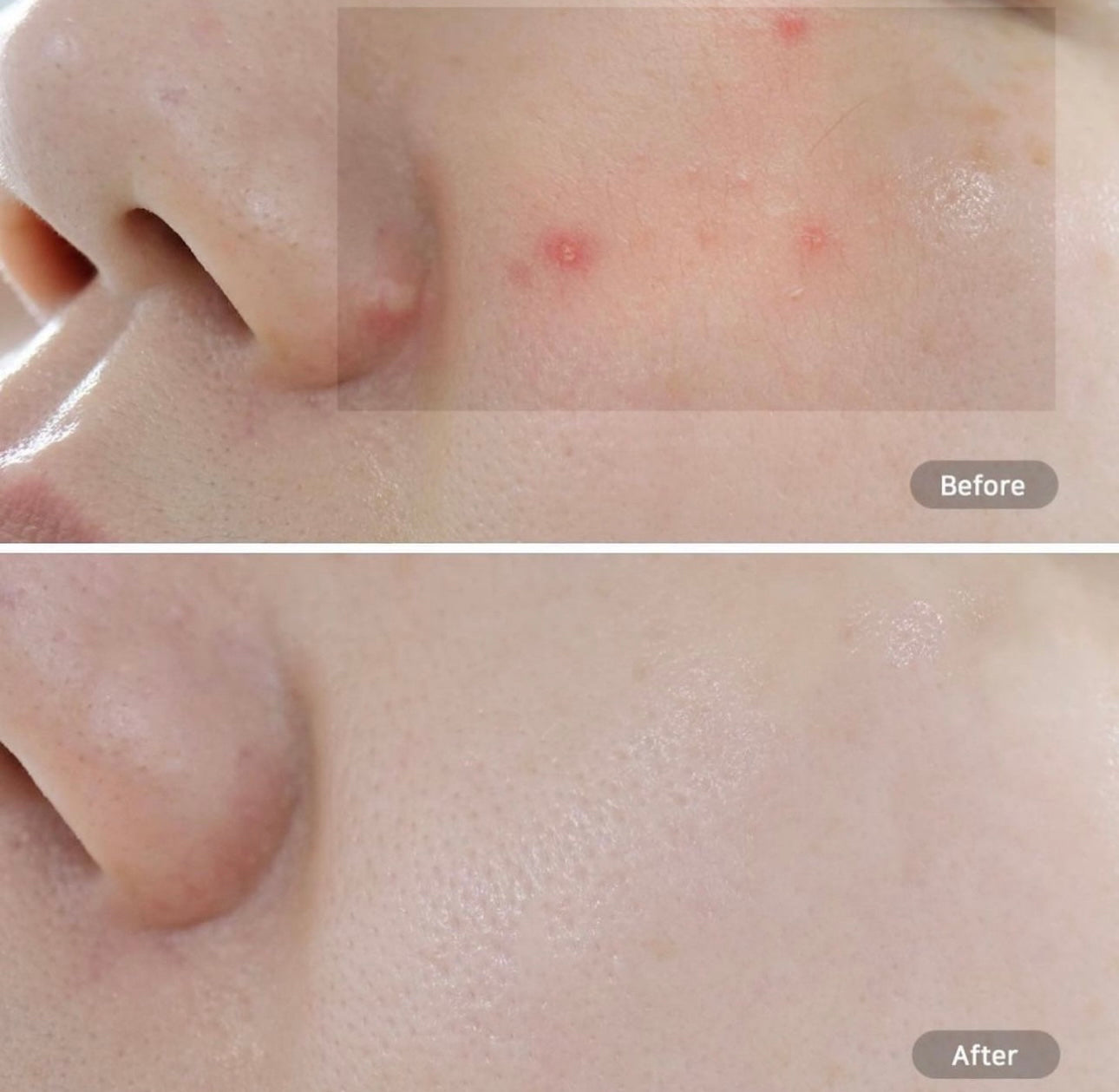 化解榜No.1✨Beplain x JOGUMAN 聯名1+1套裝 💚🦖 平衡pH值氨基酸絲滑綠豆洗面奶 Beplain Greenful pH-balanced Cleansing Foam