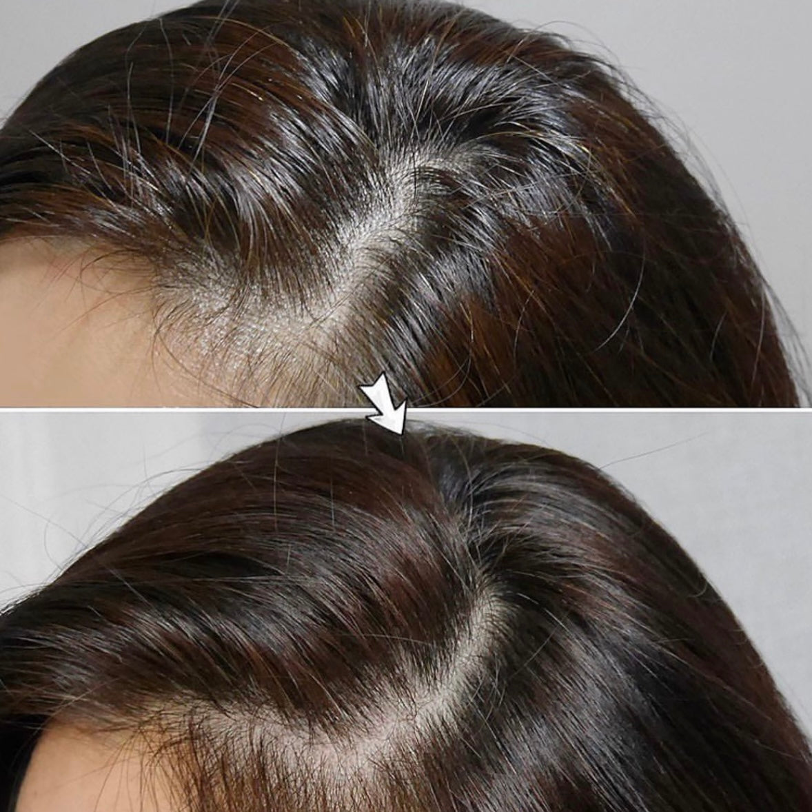 送MNH黑貓匙扣💚LABO-H HAIR LOSS RELIEF SHAMPOO專利益生菌防脫洗髮水🪄