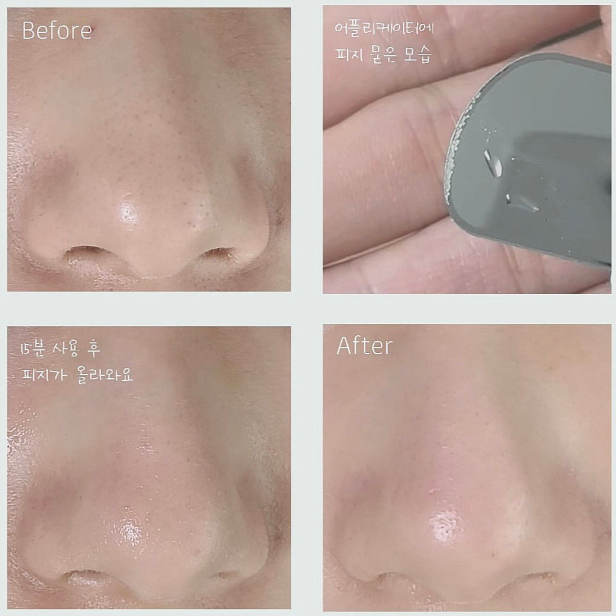 黑頭粉刺必試款🧹| Ilso溶解皮脂收毛孔導出液 Ilso Super Melting Sebum Softener✨