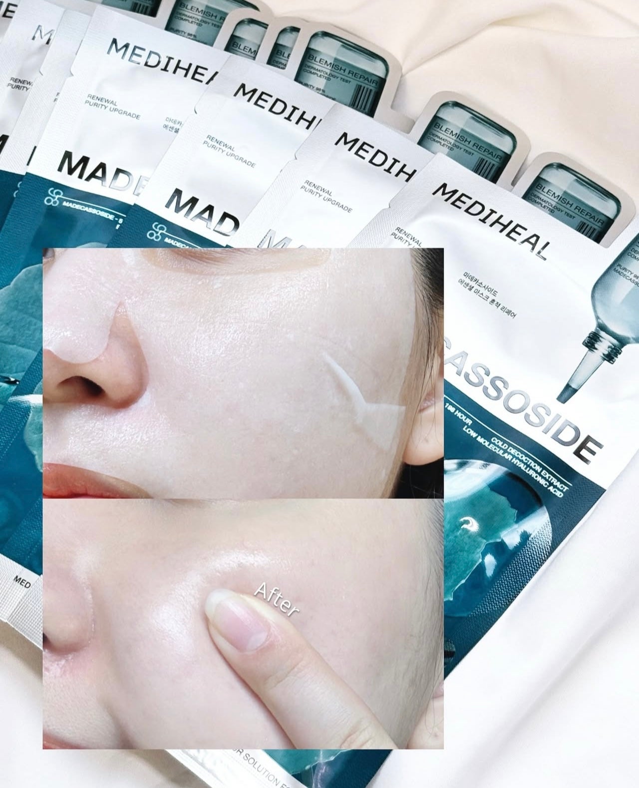 針對瑕疵和痘印 ✨| Mediheal 活性積雪草鎮靜去印保濕面膜| Mediheal Madecassoide Essential Mask🌿