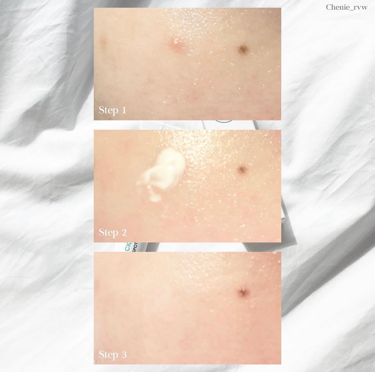 敏感痘痘肌必備✨| Beplain積雪草修復袪痘精華乳霜🌿Beplain Cicaterol Spot Treatment