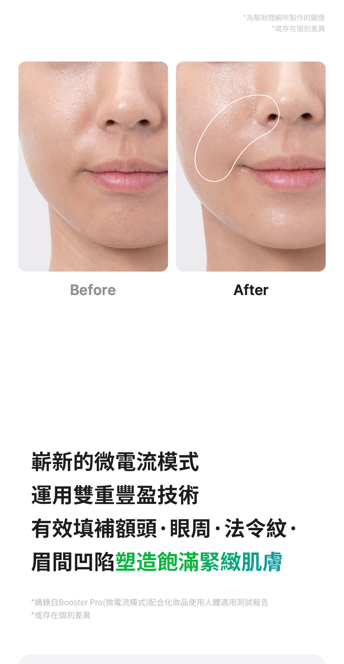 六種技術於一身的終極美容儀器 ⭐️Medicube 6合1 Booster Pro逆齡提升水光針導入美容儀🧏🏻♀️
