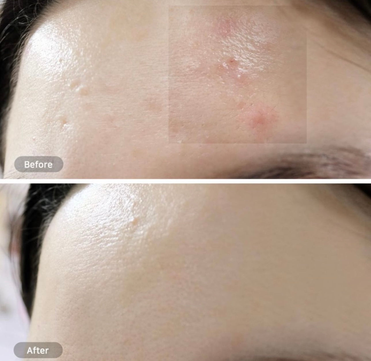 化解榜No.1✨Beplain x JOGUMAN 聯名1+1套裝 💚🦖 平衡pH值氨基酸絲滑綠豆洗面奶 Beplain Greenful pH-balanced Cleansing Foam