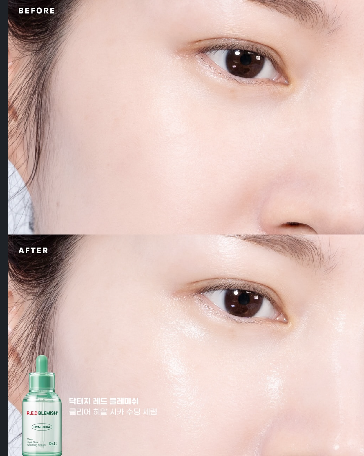 專為敏感肌膚而設💚| Dr.G 舒緩降紅去痘保濕修復精華 Red Blemish Clear Hyal Cica Soothing Serum