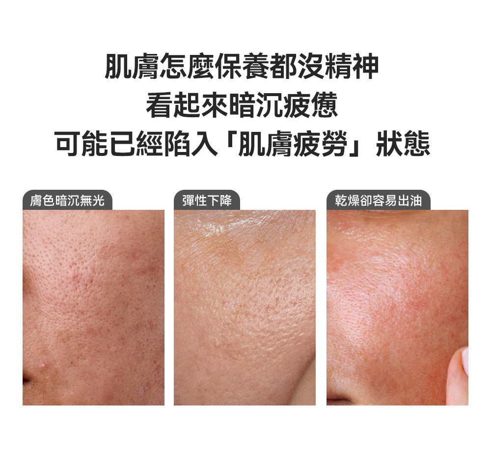 高濃度 NMN 配方💫| Sungboon Editor 綠蕃茄NMN立體塑顏毛孔精華🌿🍅升級版✨