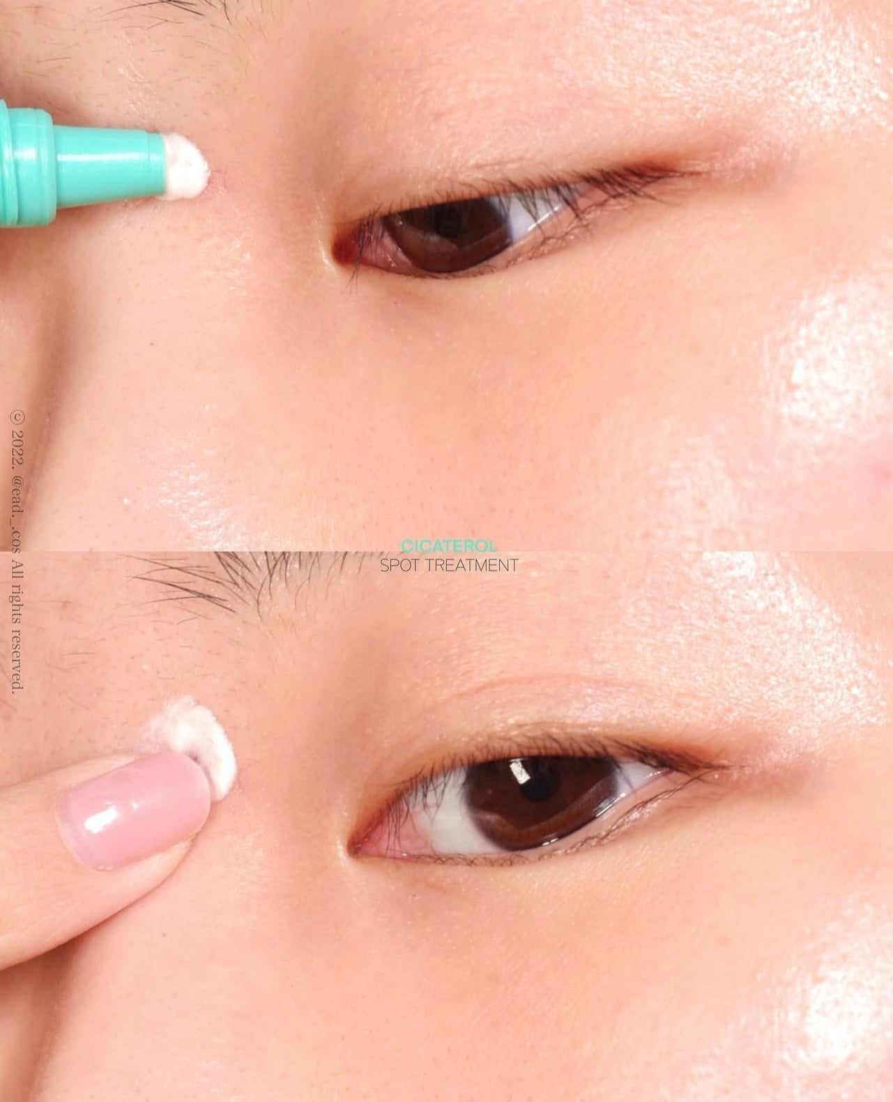敏感痘痘肌必備✨| Beplain積雪草修復袪痘精華乳霜🌿Beplain Cicaterol Spot Treatment