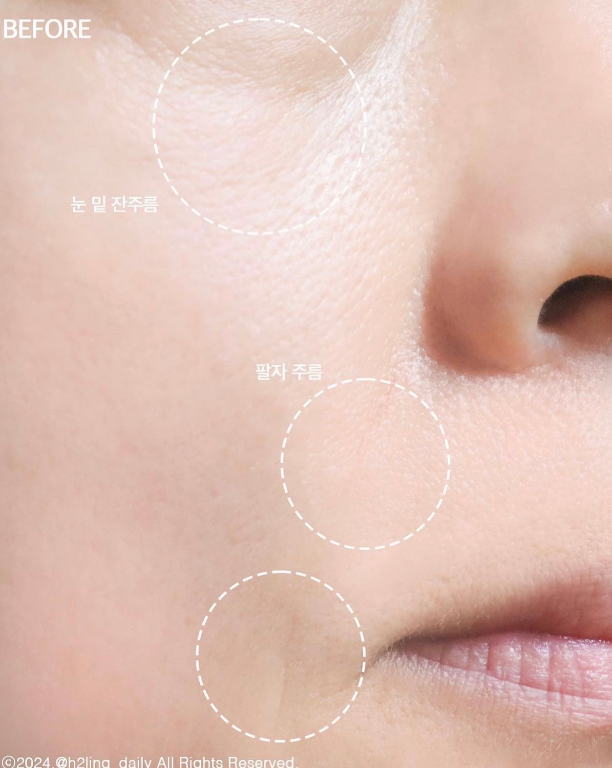 最近韓國熱賣❤️🔥MARSHIQUE 高效抗皺護理貼片| MARSHIQUE Wrinkle Repair Patch | 針對法令紋✨