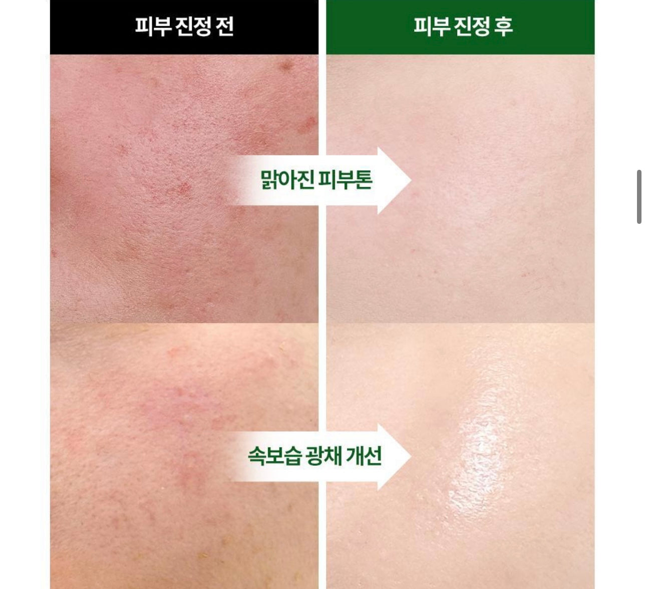 MEDIHEAL茶樹暗瘡舒緩保濕安瓶精華 | MEDIHEAL Tea Tree calming moisture Ampoule🌿