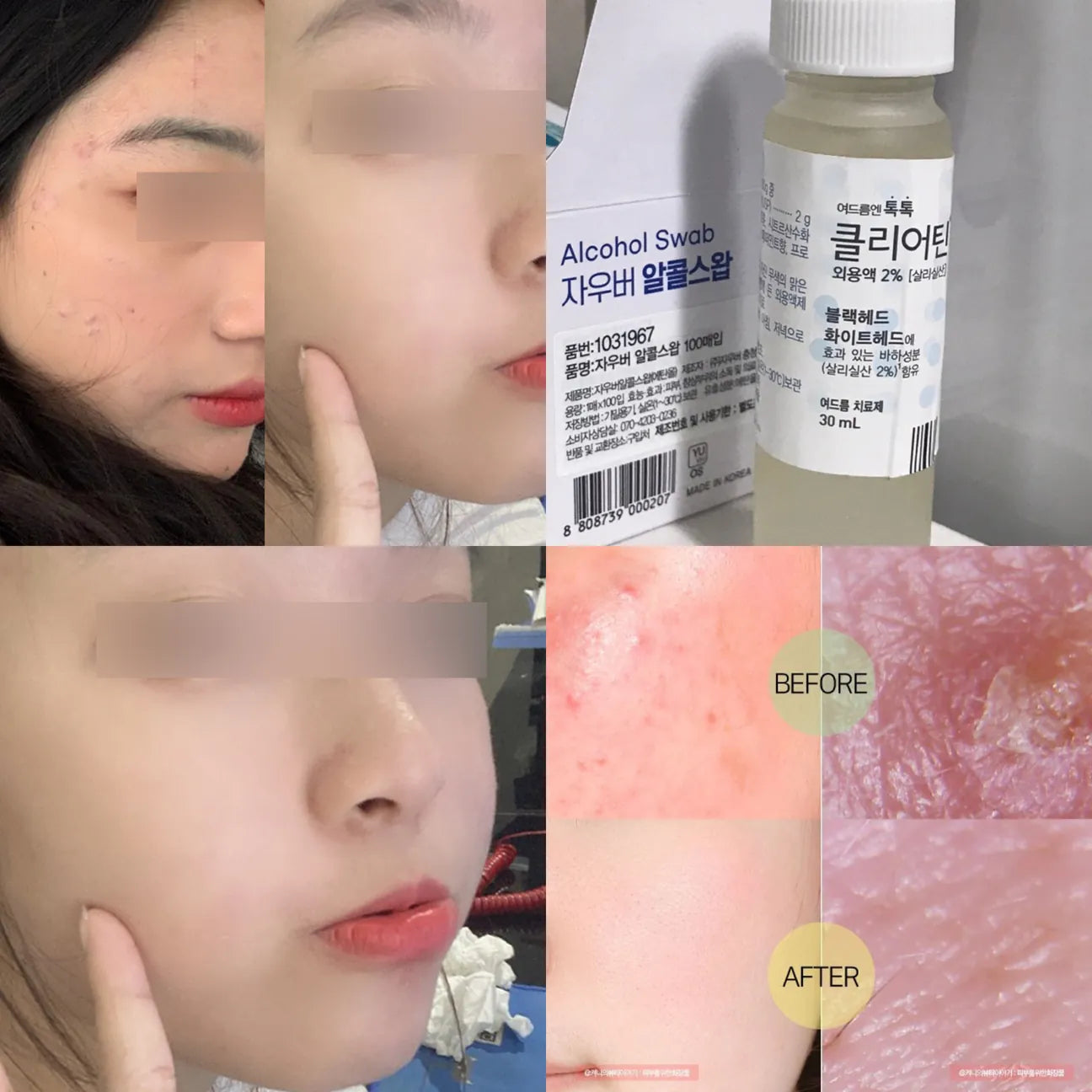 韓國藥房專賣🤍Handok 韓國國民去痘痘水| Handok Topical Acne Treatment