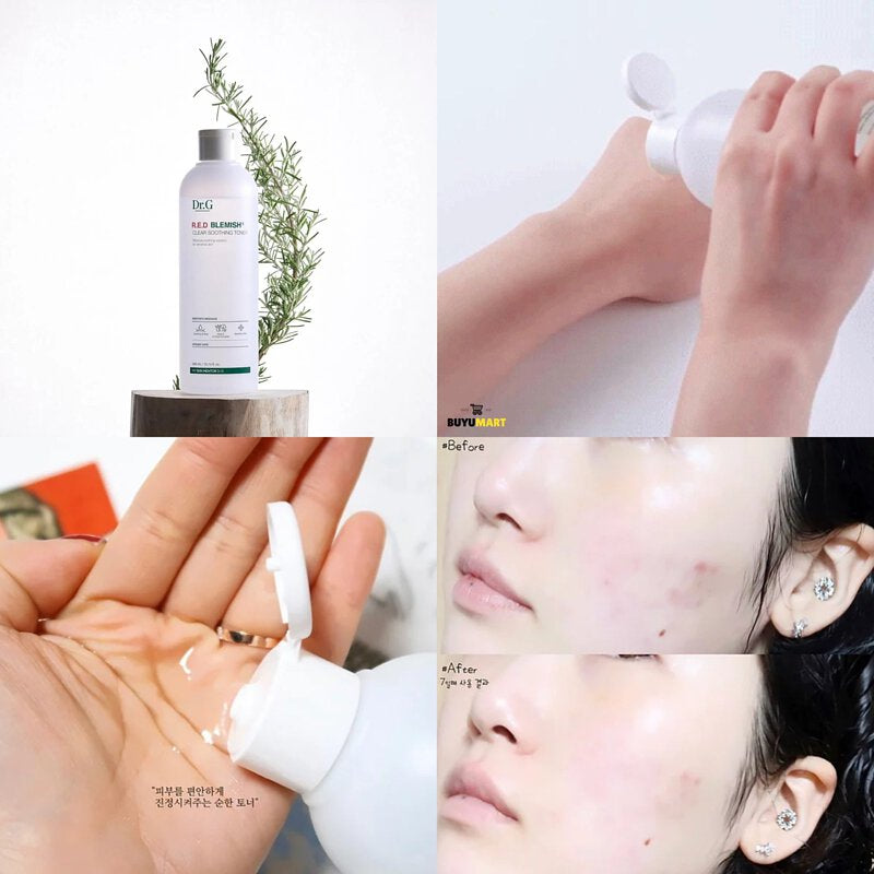 專為敏感肌而設| Dr.G 五重積雪草舒敏補濕爽膚水🌿| Dr.G Red Blemish Soothing Toner💧
