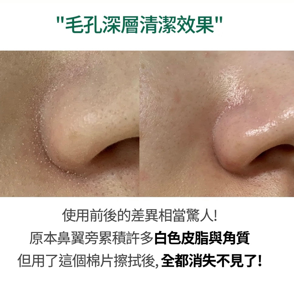 清潔毛孔x 緊緻毛孔 SUNGBOON EDITOR 綠番茄緊緻毛孔去角質棉片Green Tomato Pore Peeling Jumbo Pad💚