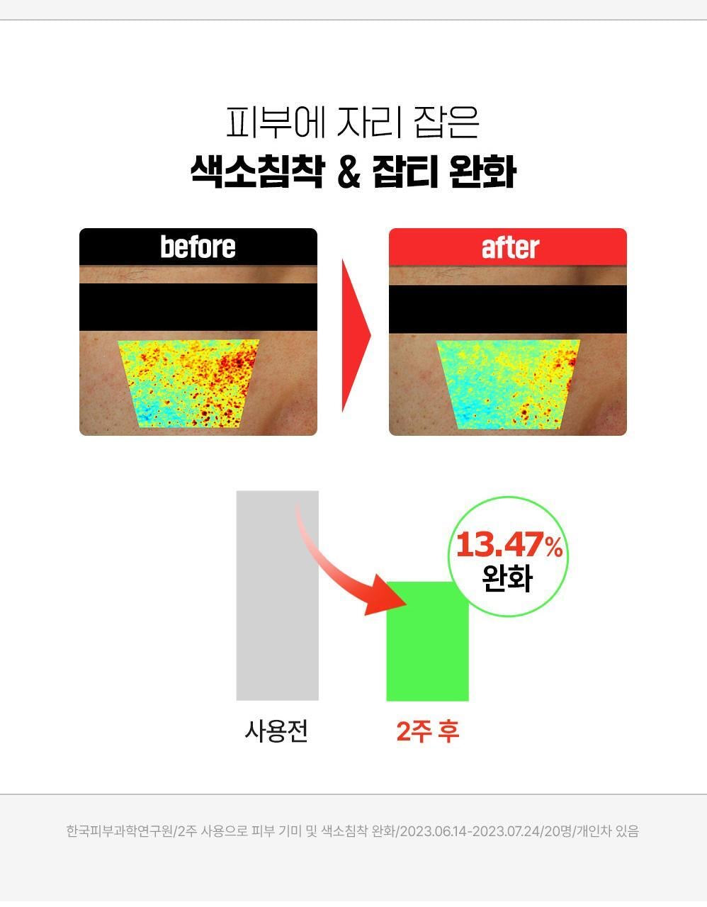 贈祛痘修護精華🌿 FATION 煥顏急救祛痘印修護安瓶💚