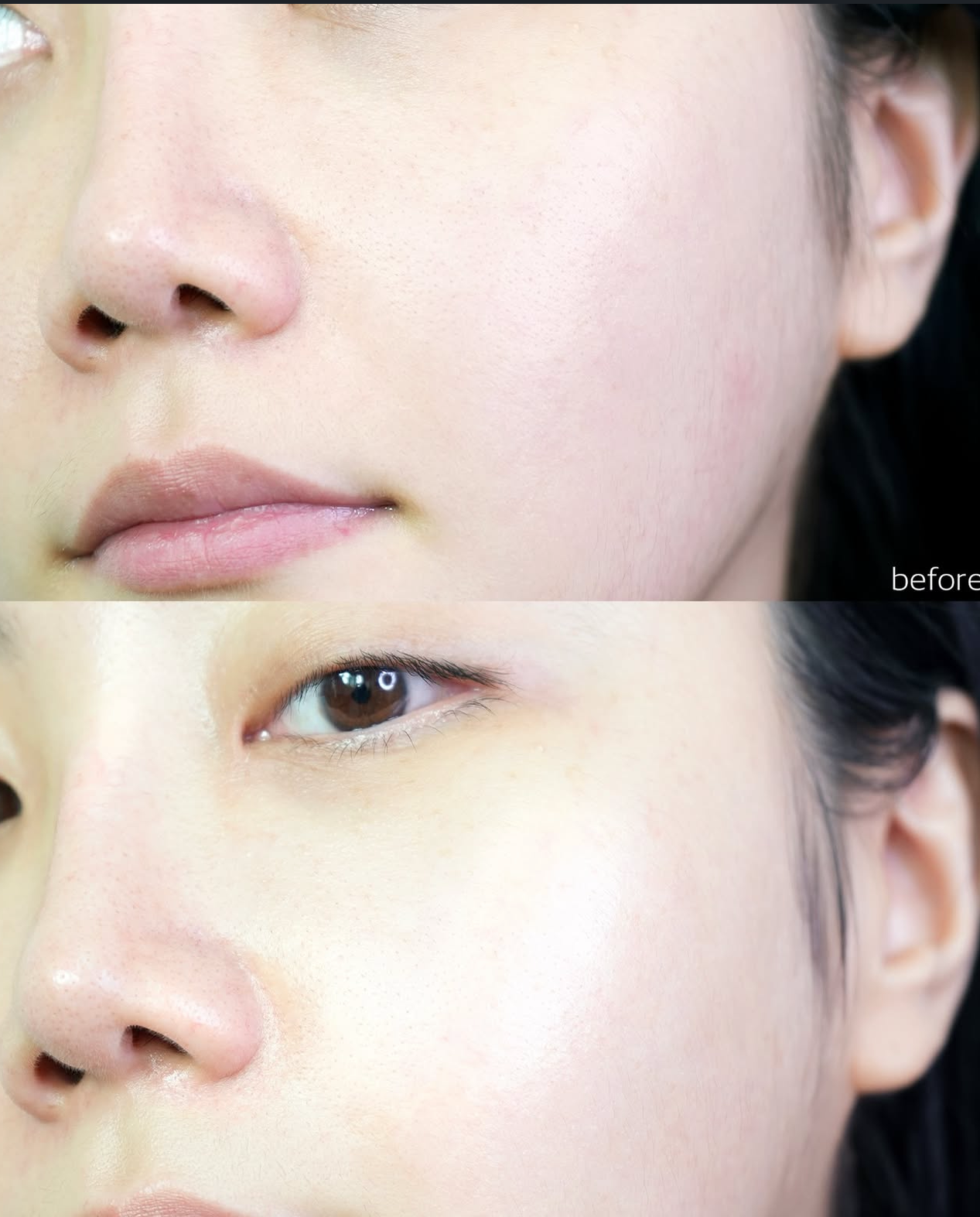 一抹彈滑 細緻毛孔✨ BOH 膠原蛋白毛孔急緊膚急救棉片|PROBIODERM™ Collagen Remodeling Serum Pads💜