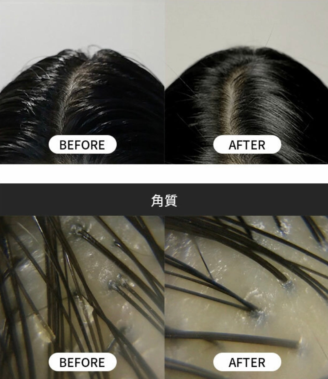 海水浴療法💆🏼♀️| GROWUS Sea Salt Therapy Scalp Scaler 海鹽磨砂洗髮膏💫 韓國銷量冠軍產品 No.1🥂
