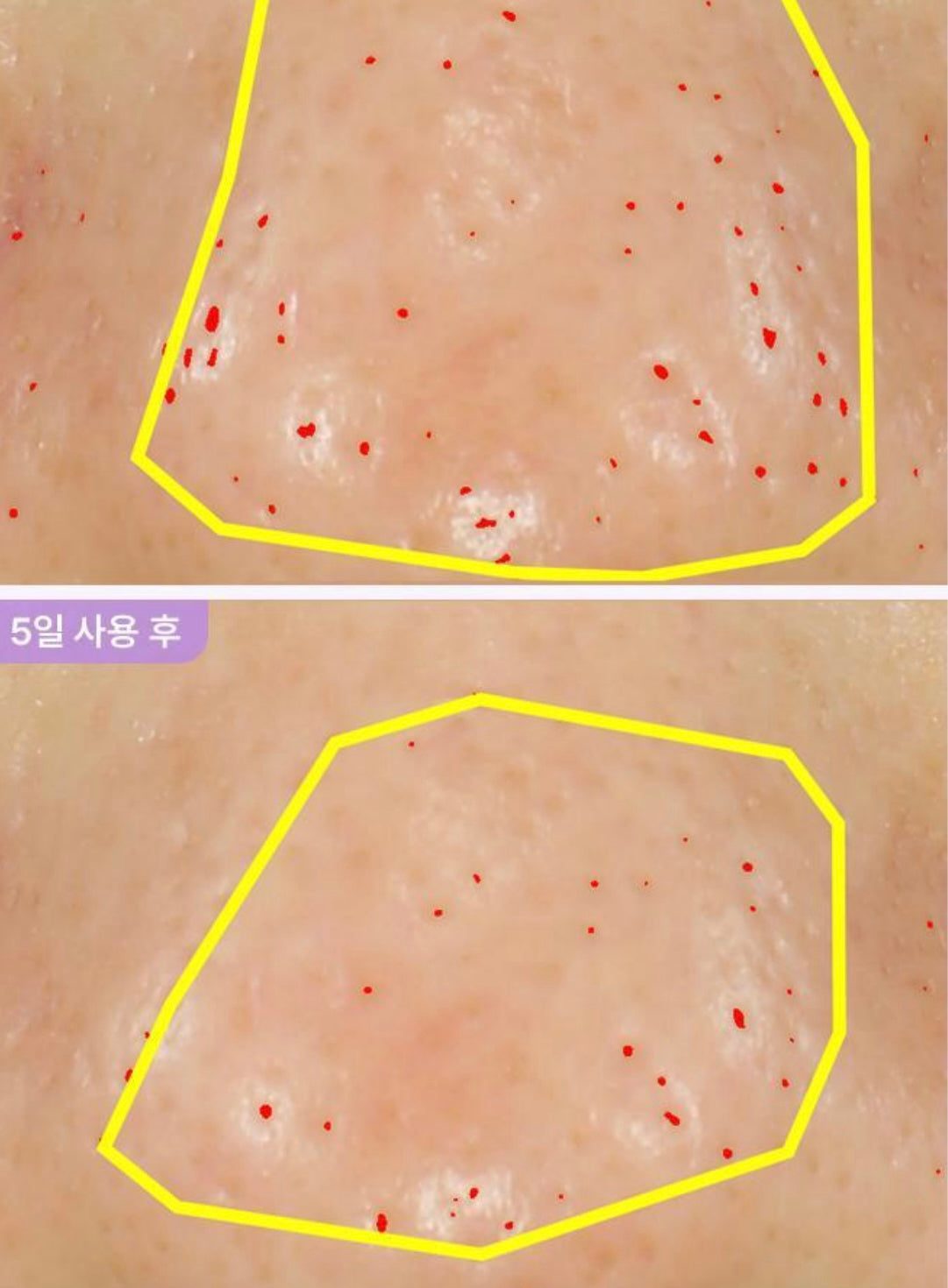 BIOHEAL BOH 益生菌膠原蛋白重塑紋理精華| PROBIODERM™ COLLAGEN REMODELING SERUM GEOBIODER