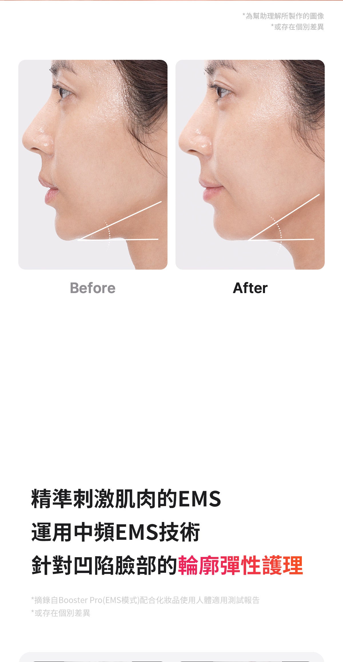 六種技術於一身的終極美容儀器 ⭐️Medicube 6合1 Booster Pro逆齡提升水光針導入美容儀🧏🏻♀️