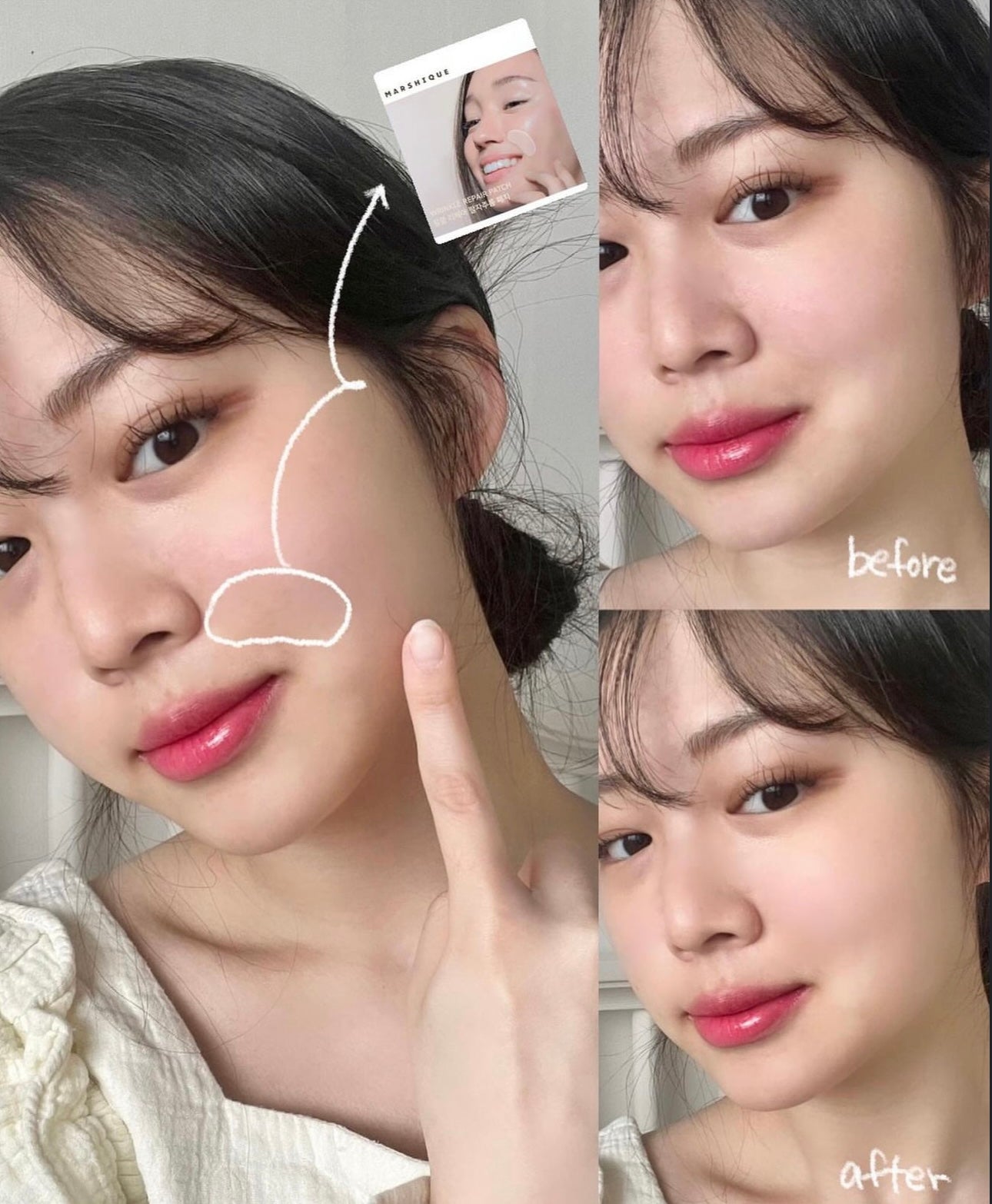 最近韓國熱賣❤️🔥MARSHIQUE 高效抗皺護理貼片| MARSHIQUE Wrinkle Repair Patch | 針對法令紋✨