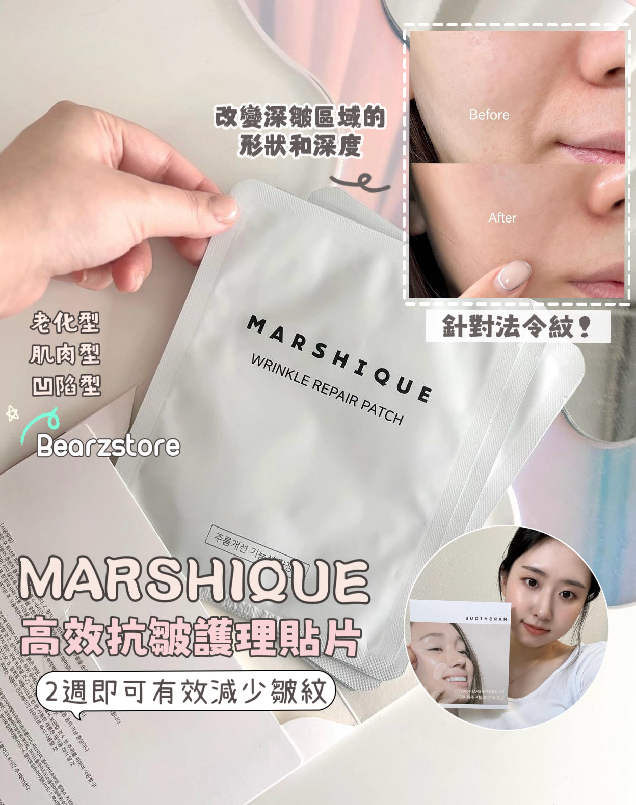 最近韓國熱賣❤️🔥MARSHIQUE 高效抗皺護理貼片| MARSHIQUE Wrinkle Repair Patch | 針對法令紋✨