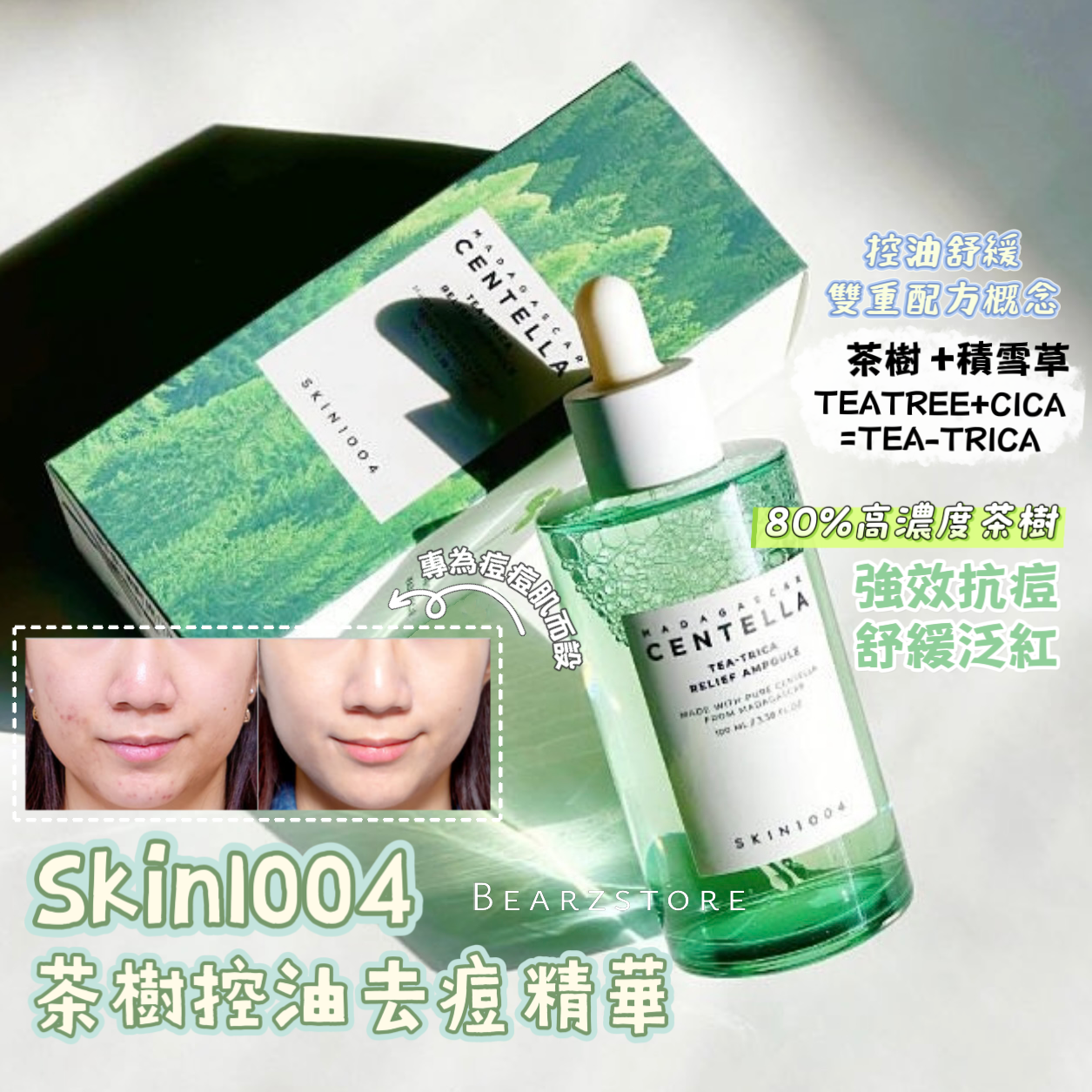 專為痘痘肌而設🌿SKIN1004馬達加斯加積雪草茶樹控油去痘精華| Madagascar Centella Tea-Trica Relief Ampoule