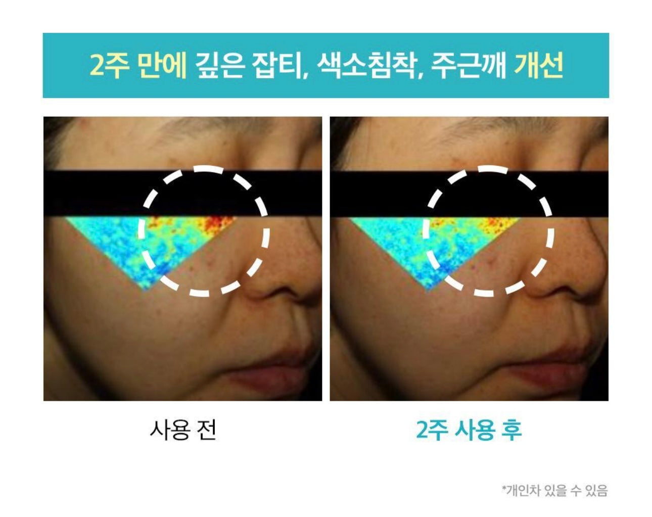 MEDIHEAL 積雪草修復舒緩淡印精華| MEDIHEAL Madecassoside Blemish Pad💡美白去印減暗沉護膚