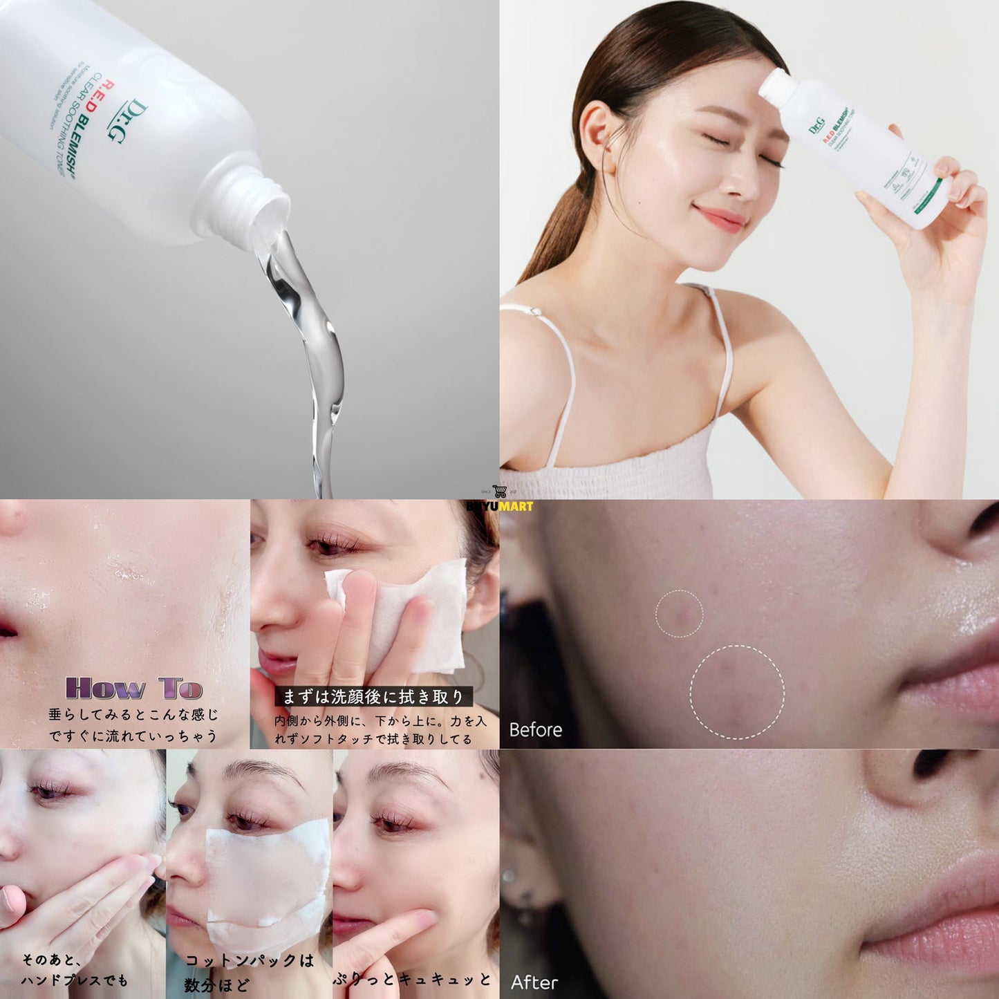 專為敏感肌而設| Dr.G 五重積雪草舒敏補濕爽膚水🌿| Dr.G Red Blemish Soothing Toner💧