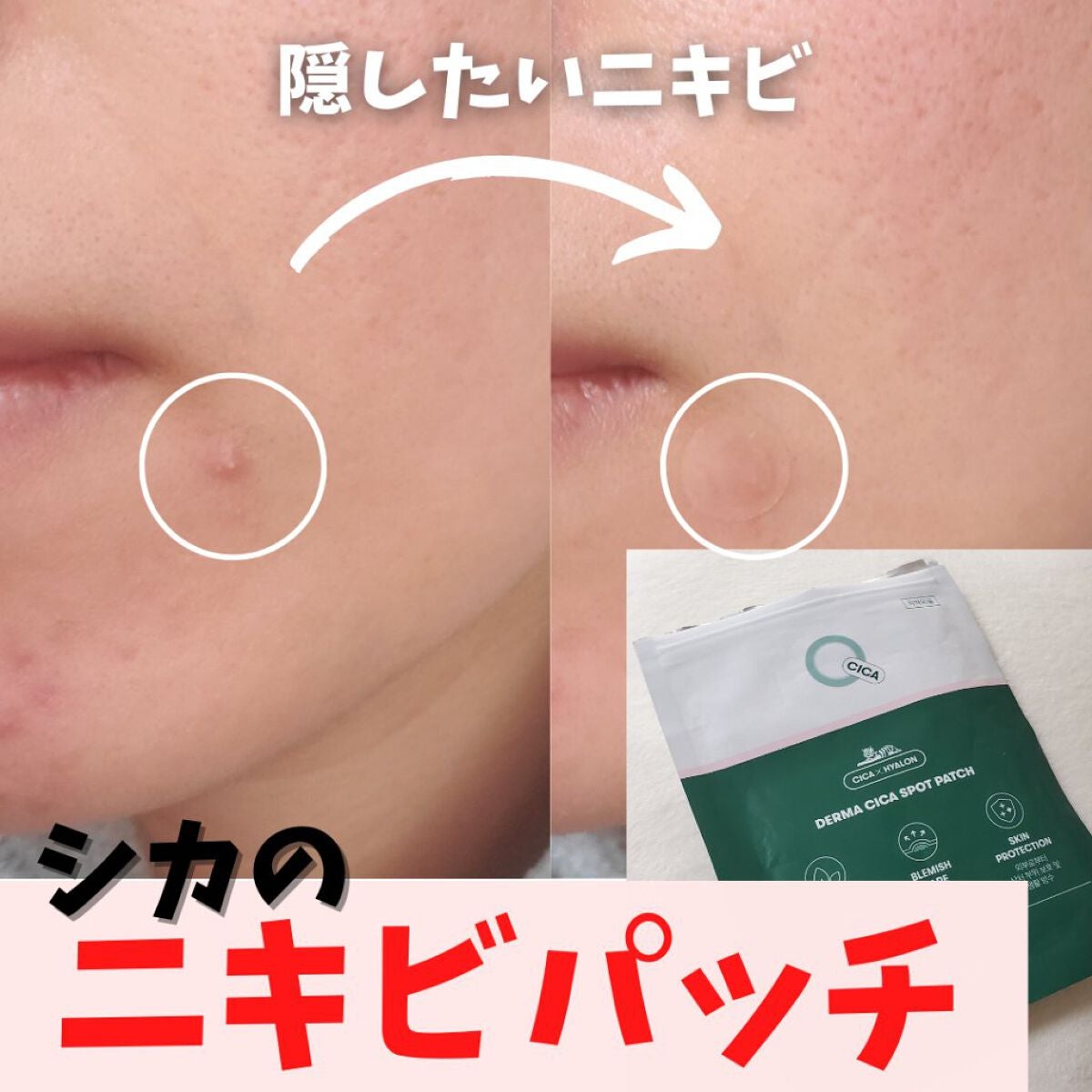 隱形隔離 消炎修護 💖| VT Cosmetics 老虎積雪草隱形修復痘痘貼 66片 CICA Spot Patch 🌿