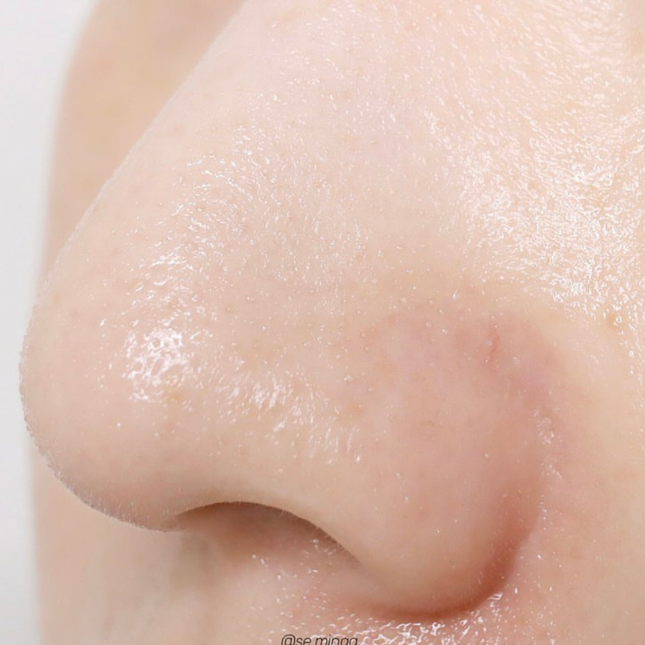 黑頭粉刺必試款🧹| Ilso溶解皮脂收毛孔導出液 Ilso Super Melting Sebum Softener✨