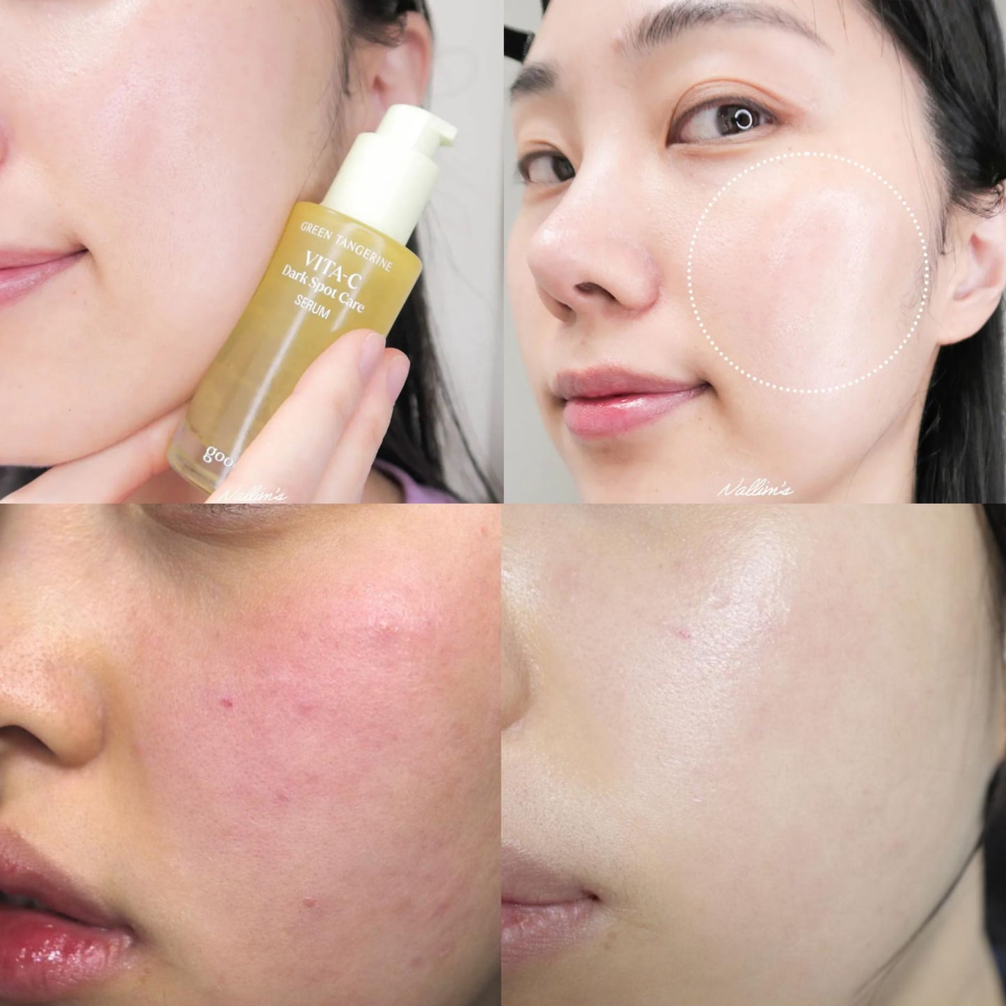 共100ml+送化妝袋 ✨新版本2倍濃度🍊 Goodal青橘子美白淡斑去印保濕精華| 4週告別瑕疵💡