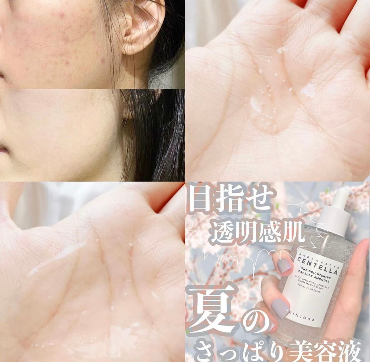 SKIN1004 馬達加斯加積雪草美白膠囊微粒精華100ml🤍|光感亮白 擊退暗沉🌻