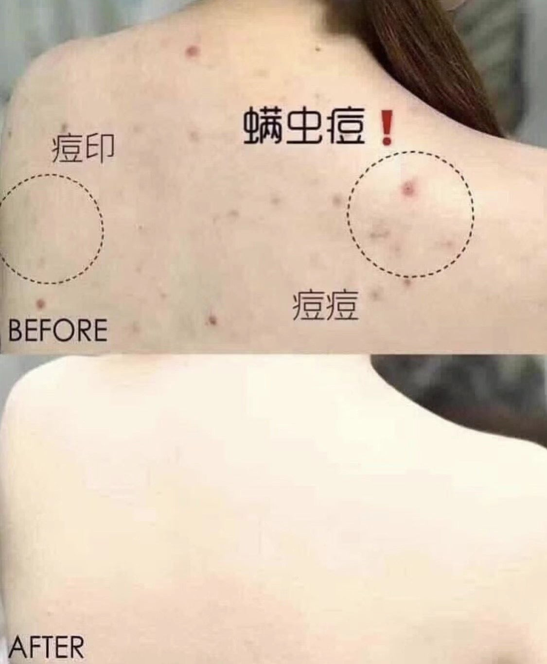 MERPHIL AC+MAGIC CLEANSER 身體消炎去痘沐浴露 ✨