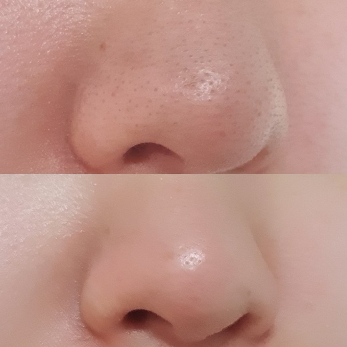 韓國RNW 去黑頭 粉刺 痘痘蟎蟲 收縮毛孔鼻貼✨