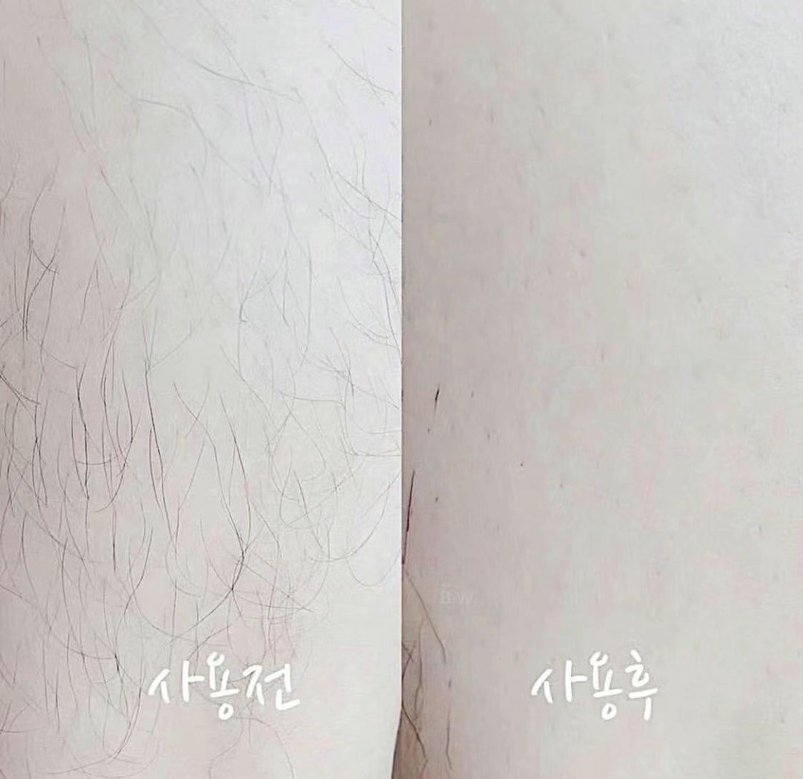 熱賣🔥Medipickme Touch-up 不沾手無痛脫毛膏💫