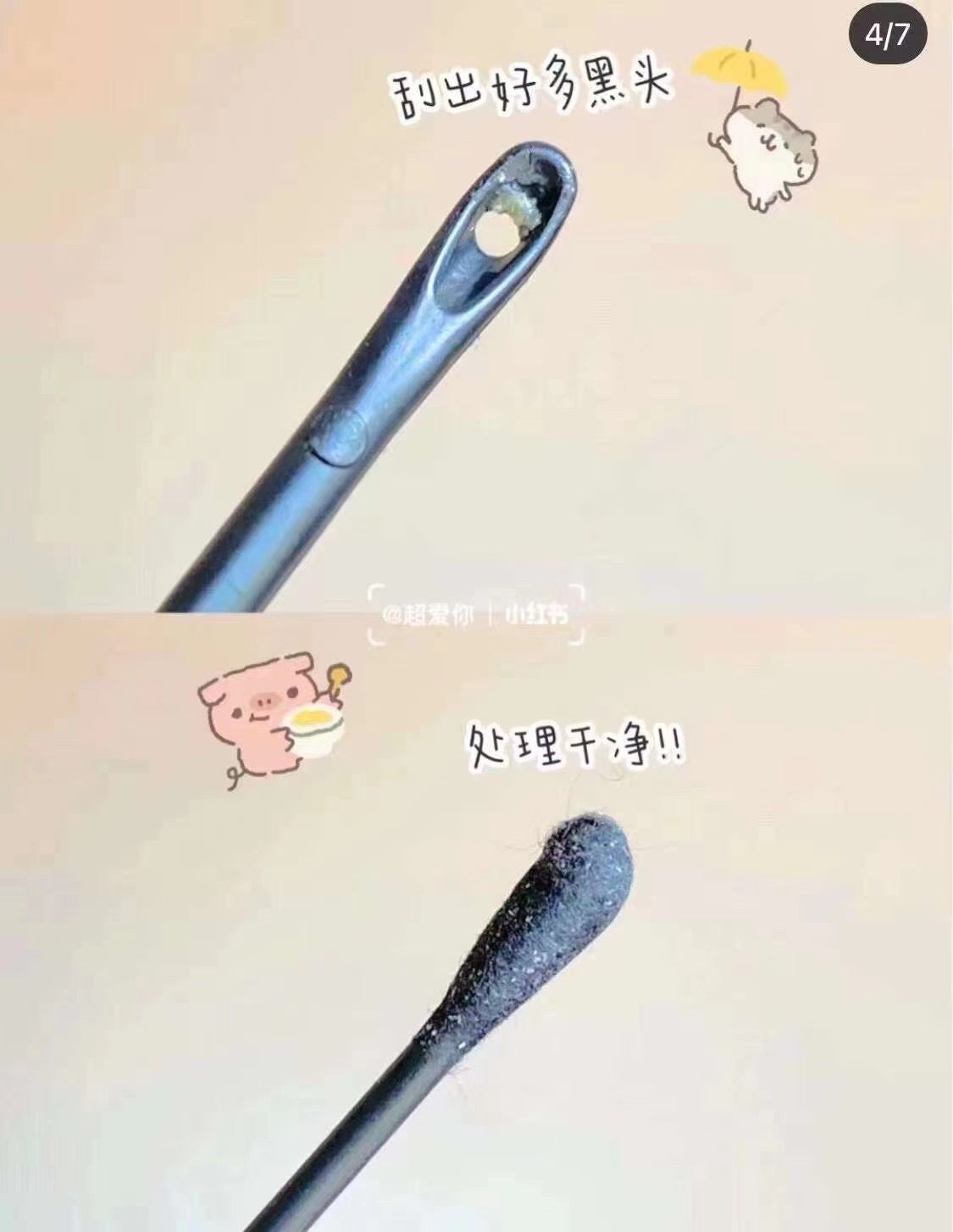 韓國RNW 去黑頭 粉刺 痘痘蟎蟲 收縮毛孔鼻貼✨